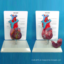 Modelo analógico de demonstração anatômica do coração com descrição (R120107)